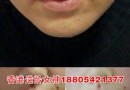 无针微整加盟哪家好？圣辉.逆龄女神无针微整是佳选